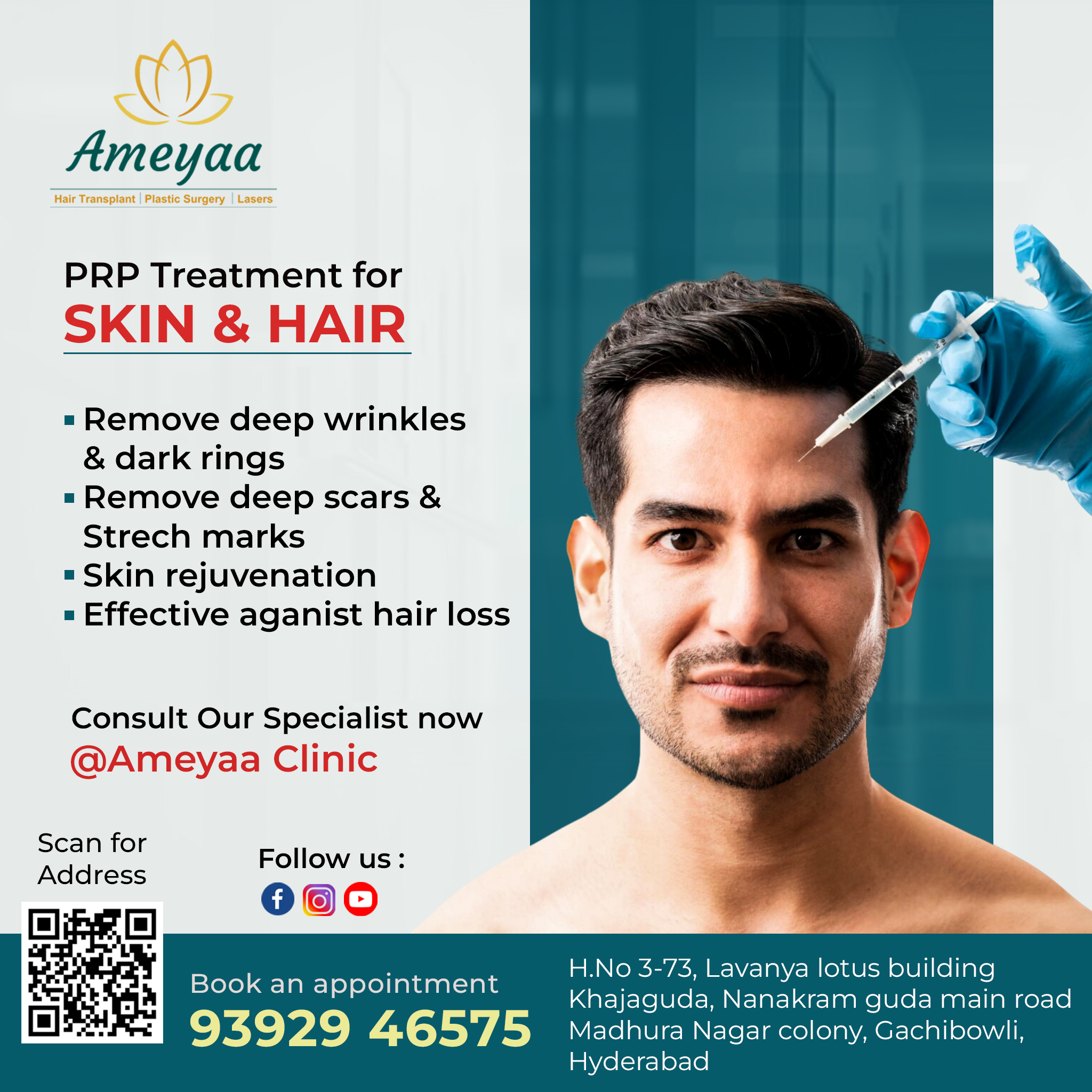 Acne Scar Removal Treatment in Gachibowli | Hyderabad – Ameyaa clinic