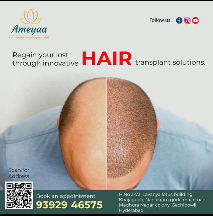 Best Hair Transplantation Clinic in Gachibowli | Hyderabad – Ameyaa clinic