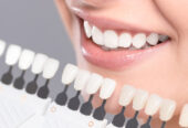 Top Dentist in Gurgaon