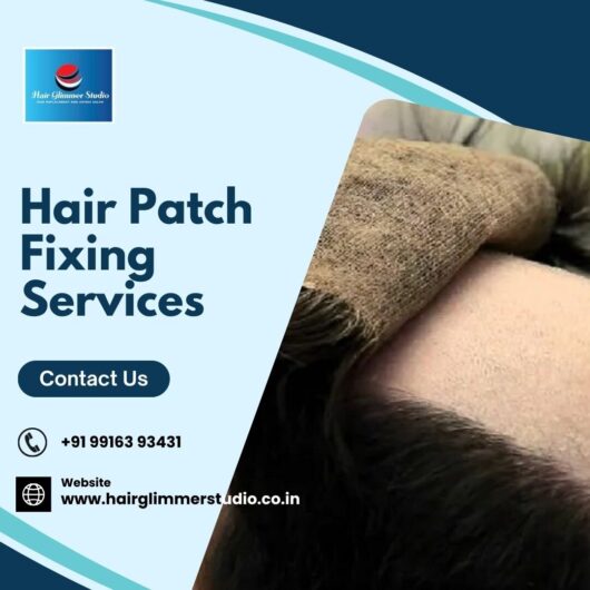 Hair Patch in Bangalore | Hair Patch Fixing in Bangalore