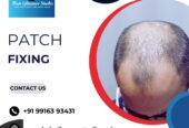 Hair Patch in Bangalore | Hair Patch Fixing in Bangalore