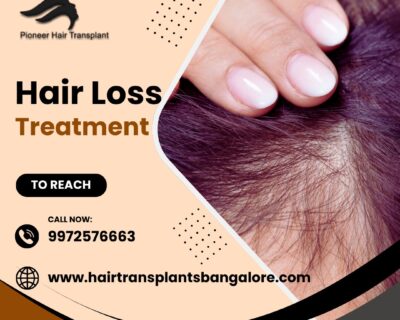 Best-Hair-Loss-Treatment-in-Bangalore-2