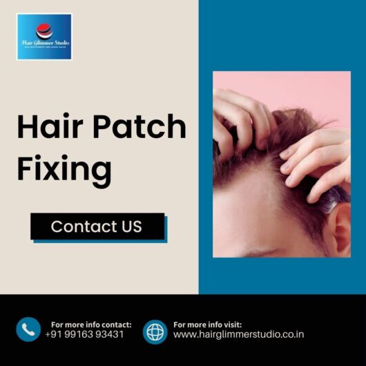 Hair Patch in Bangalore | Hair Patch Fixing in Bangalore