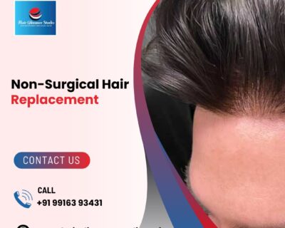 Non-Surgical-Hair-Replacement-in-Bangalore-3