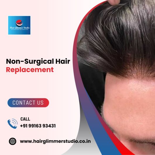 Non-Surgical Hair Replacement | Wigs Replacement Center