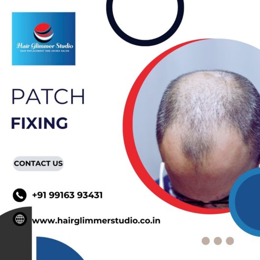 Hair Patch in Bangalore | Hair Patch Fixing in Bangalore