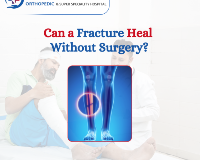 can-a-fracture-heal-without-surgery