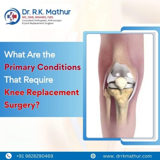 What Are the Primary Conditions That Require Knee Replacement Surgery?