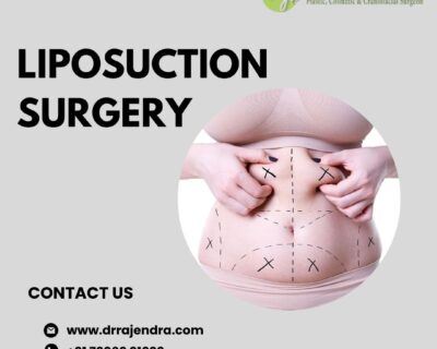 Liposuction-Cost-in-Bangalore