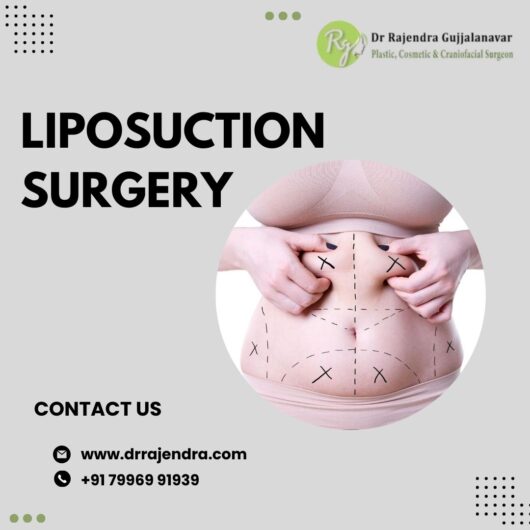Liposuction Surgery in Bangalore | Safe & Effective Fat Removal