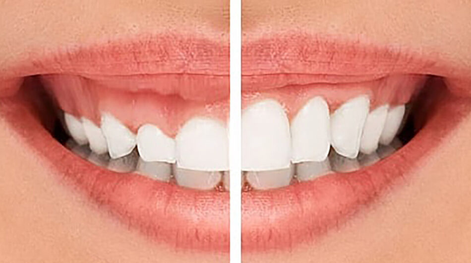 Top Dentists in Gurgaon – Ministry of Smile