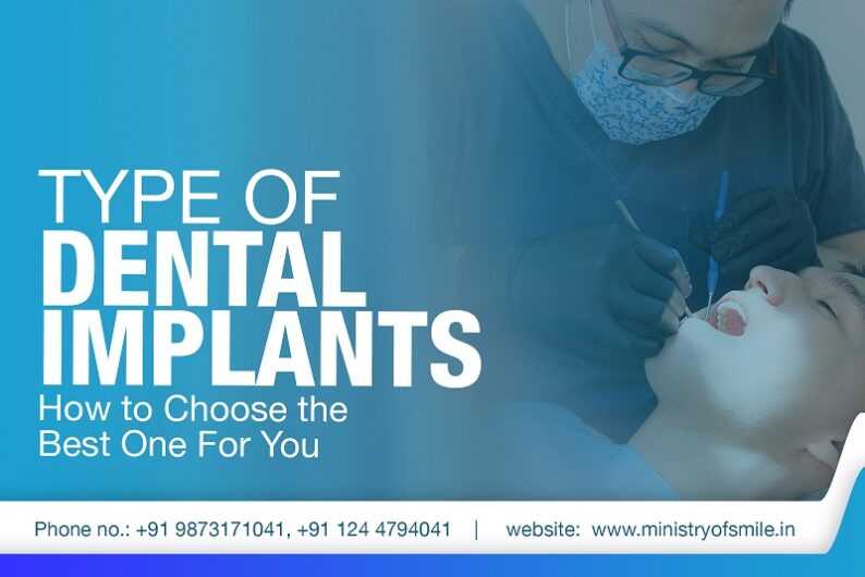 Dental Implants in Gurgaon – Ministry of Smile