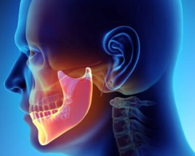 tmj-600×362-1