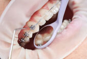 Top Reasons to Choose the Best Dental Clinic in Salem for Your Oral Health