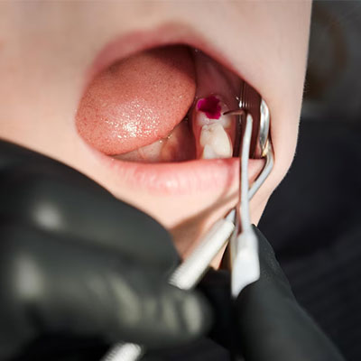 Top Reasons to Choose the Best Dental Clinic in Salem for Your Oral Health