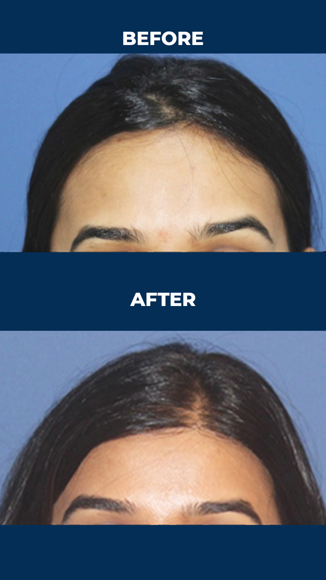 Best Cosmetic & Plastic Surgery Clinic in Hyderabad – Personiks