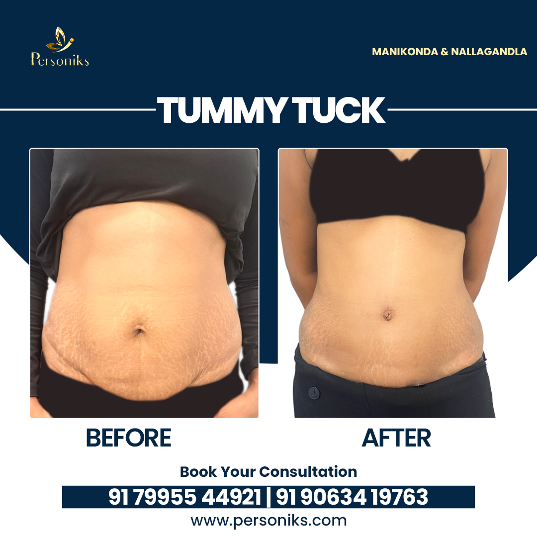 Hair Transplant, Skin & Cosmetic Surgery Specialists Near Me In Hyderabad