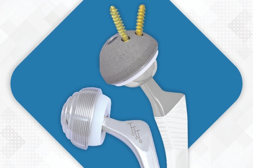 Get High-Quality Total Hip Replacement Implants with High Precision & Performance by Sharma Orthopedic