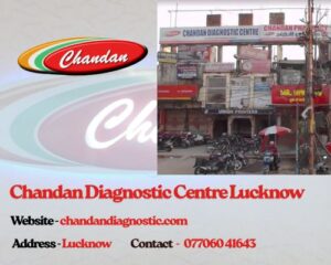 Chandan-Diagnostic-Centre-Lucknow