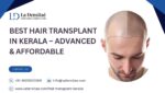 Best Hair Transplant in Kerala – Advanced & Affordable