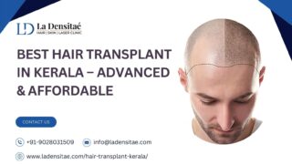Best-Hair-Transplant-in-Kerala-–-Advanced-Affordable