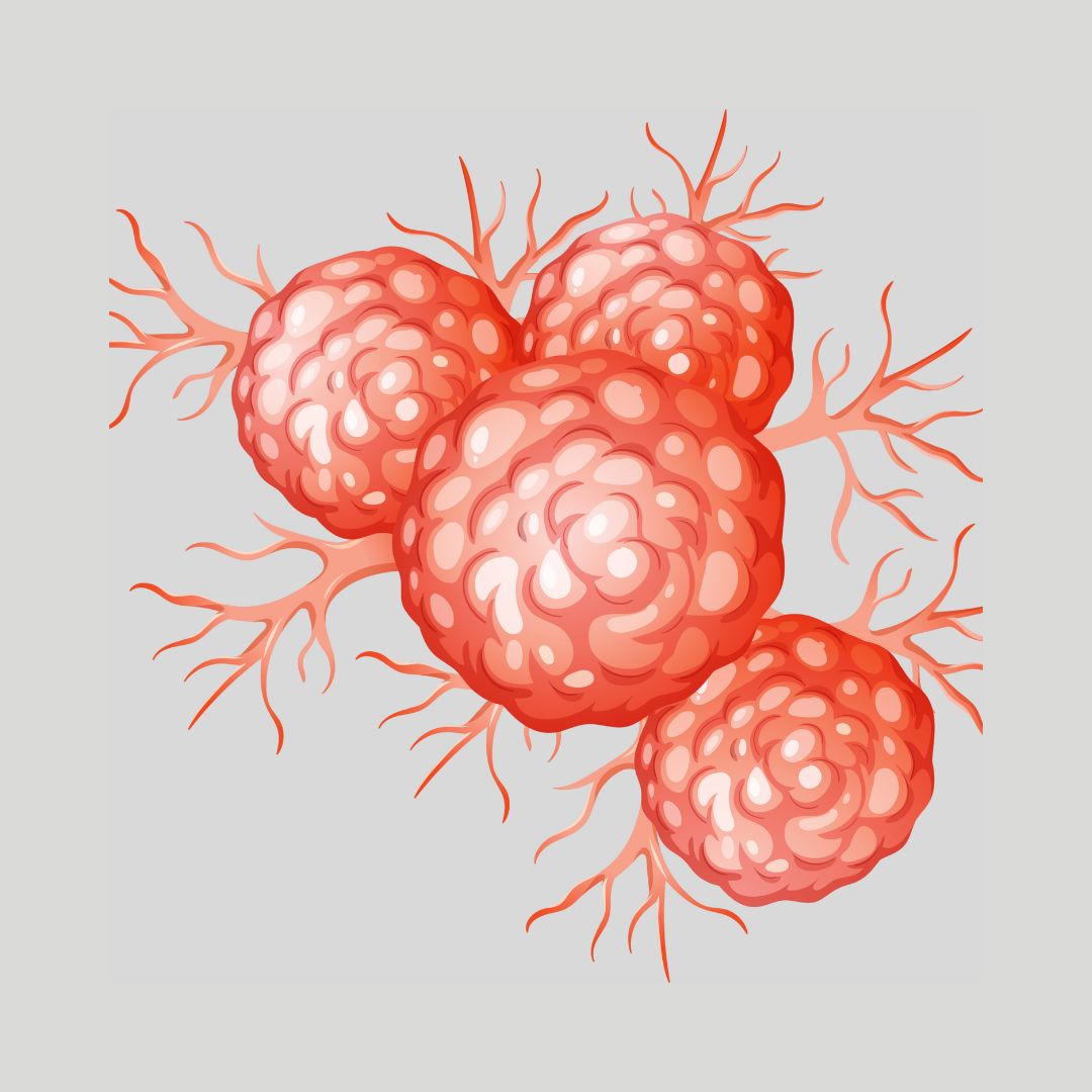 Hairy Cell Leukemia Treatment in India for Bangladesh Patients