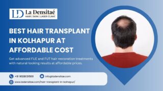 Best-Hair-Transplant-in-Kolhapur-at-Affordable-Cost