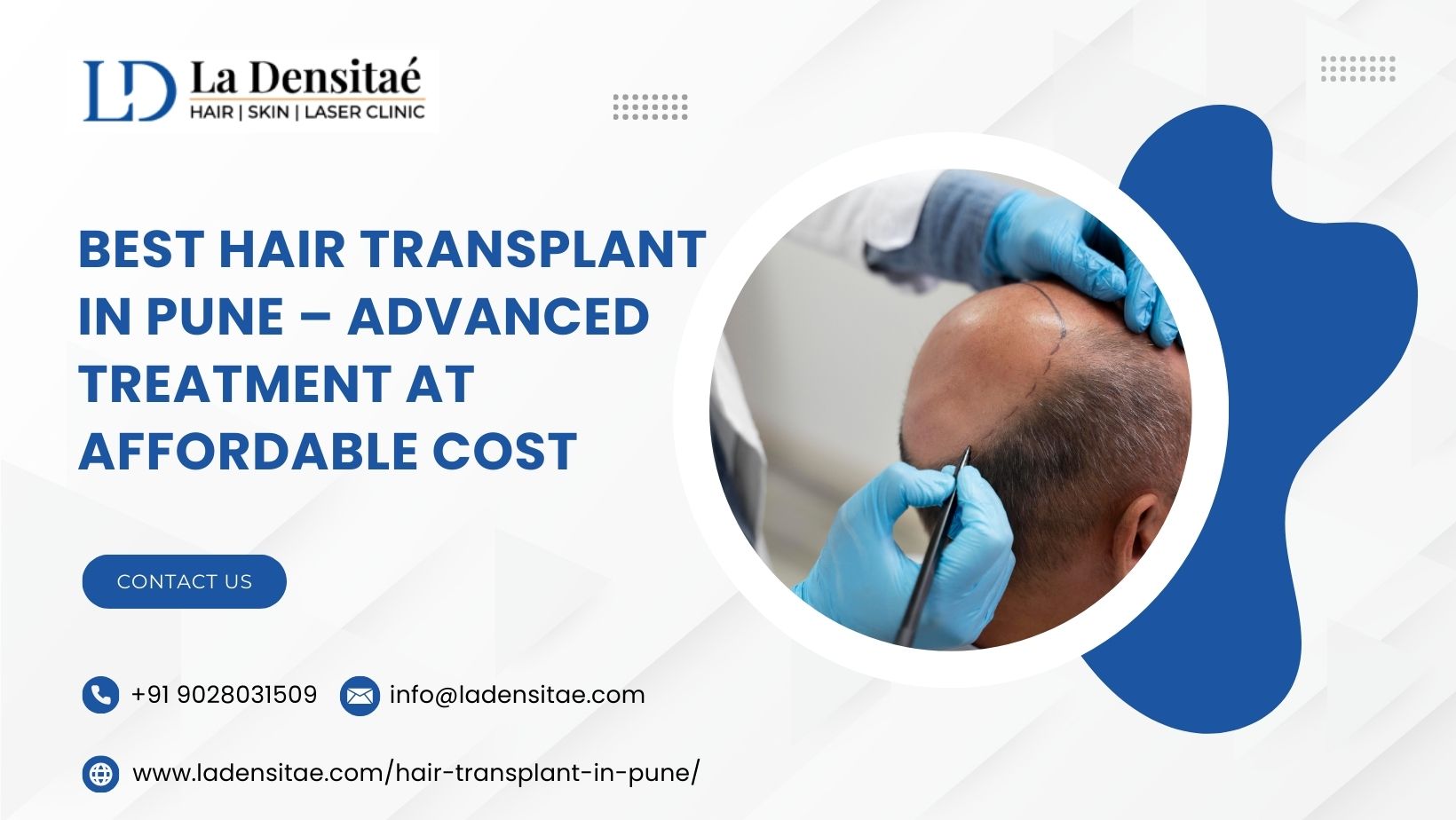 Best Hair Transplant in Pune – Advanced Treatment at Affordable Cost