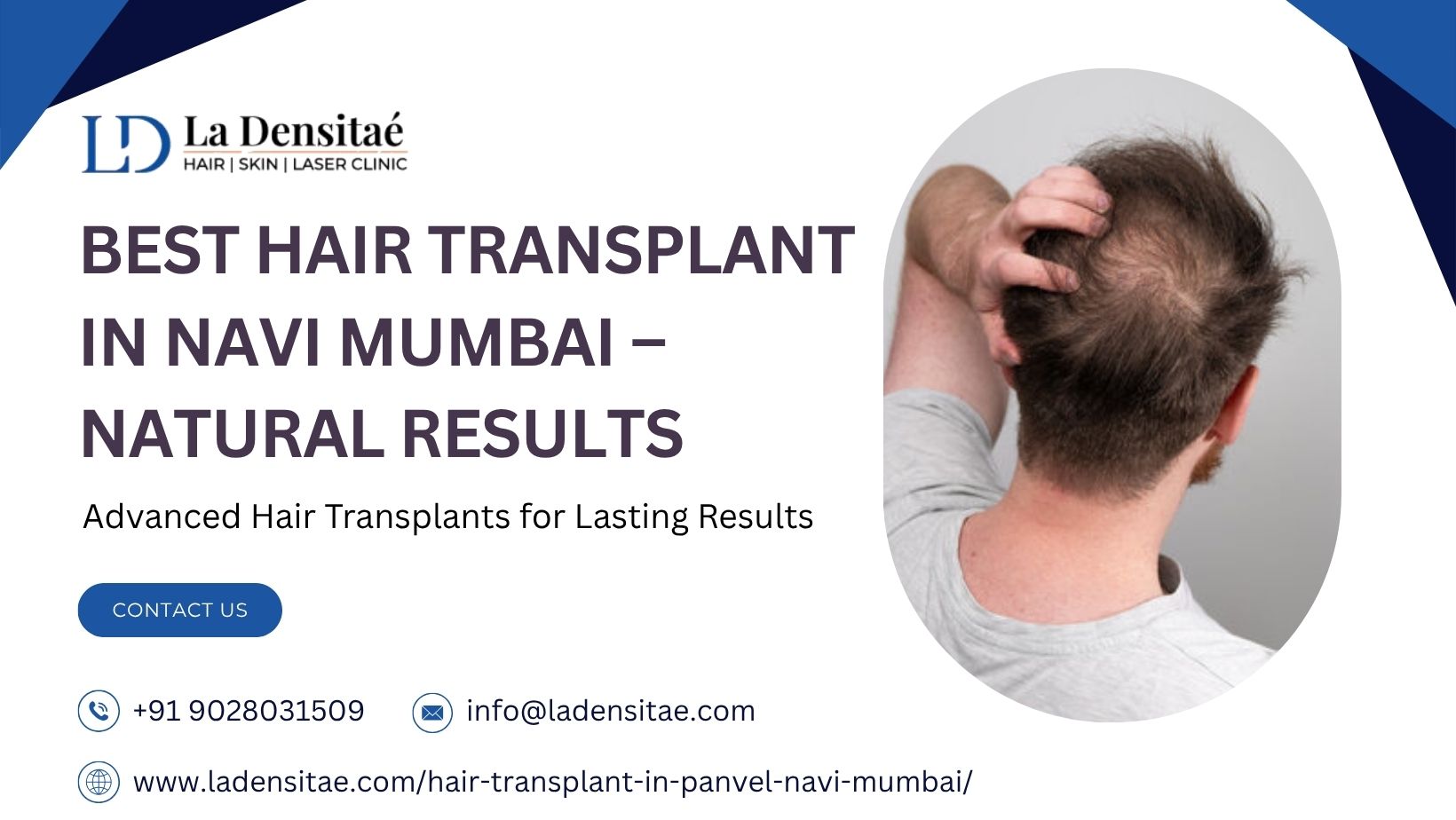 Best Hair Transplant in Navi Mumbai – Natural Results