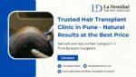 Trusted Hair Transplant Clinic in Pune — Natural Results at the Best Price