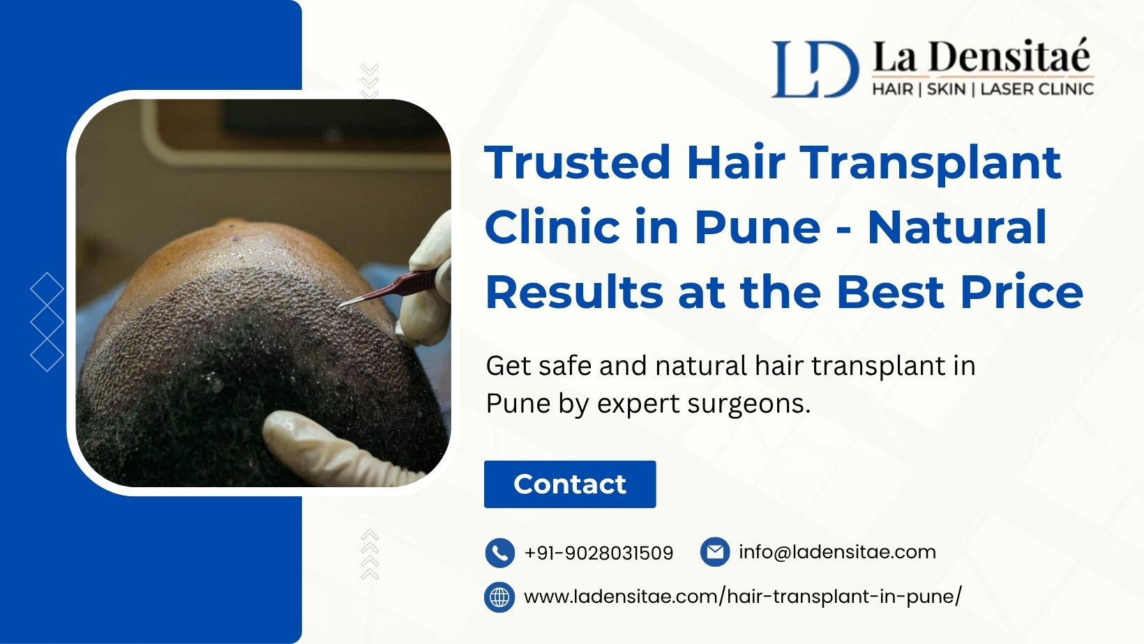 Trusted Hair Transplant Clinic in Pune — Natural Results at the Best Price