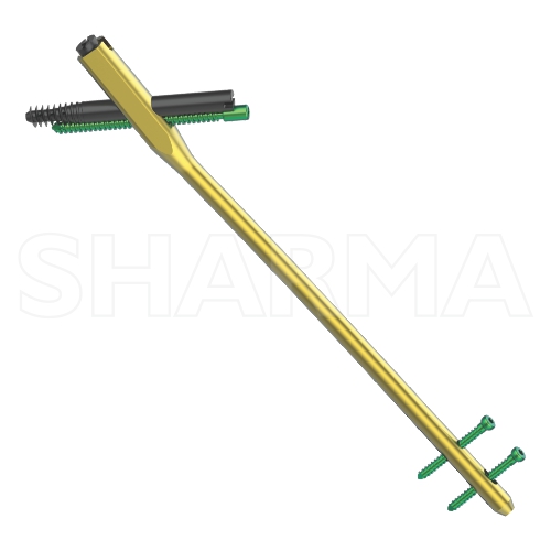 High-Quality Intramedullary Nails for Long Bone Fracture Treatment