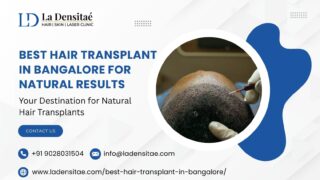 Best-Hair-Transplant-in-Bangalore-for-Natural-Results