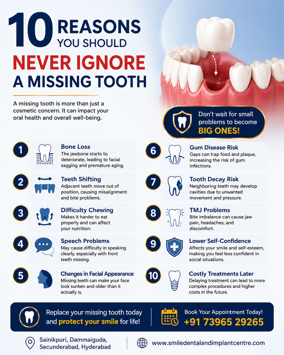 10 Reasons You Should Never Ignore a Missing Tooth – Dr Puli Sudhakar, MDS