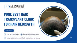 Pune-Best-Hair-Transplant-Clinic-for-Hair-Regrowth