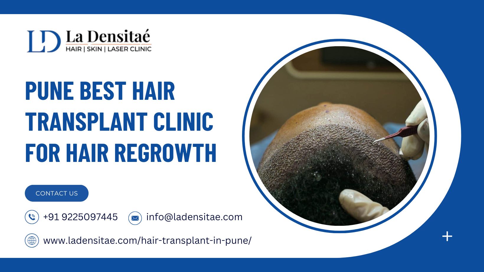 Pune Best Hair Transplant Clinic for Hair Regrowth