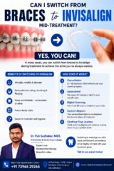 Switch-invisalign