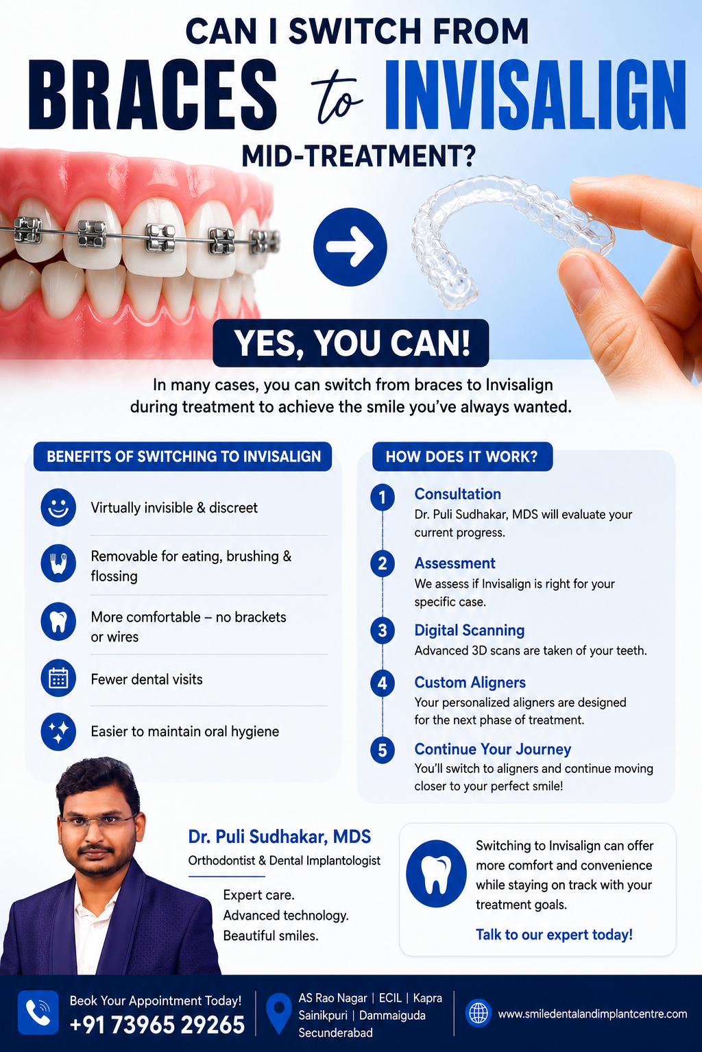 Unhappy with Metal Braces? Switch to Invisalign at Smile Dental – ECIL