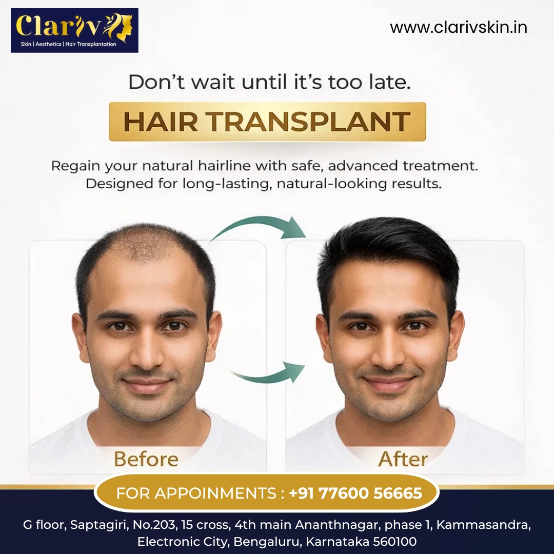 Expert Dermatologist in Bangalore for Healthy, Glowing Skin