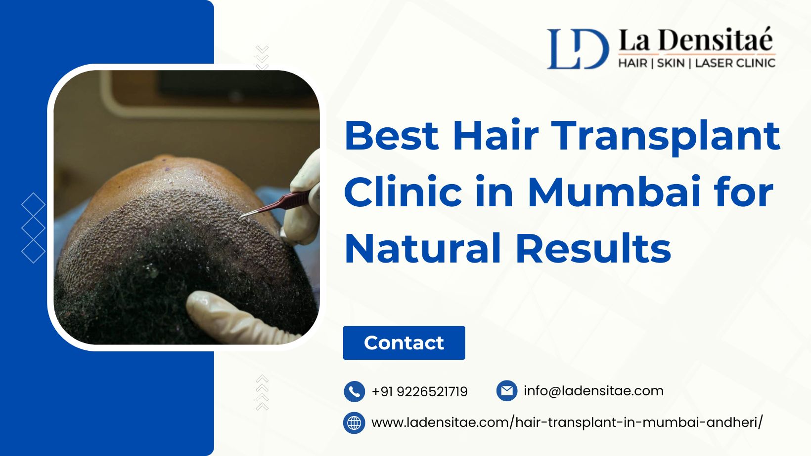 Best Hair Transplant Clinic in Mumbai for Natural Results