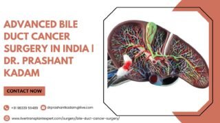 Advanced-Bile-Duct-Cancer-Surgery-in-India-Dr.-Prashant-Kadam