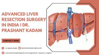 Advanced-Liver-Resection-Surgery-in-India-Dr.-Prashant-Kadam