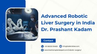 Advanced-Robotic-Liver-Surgery-in-India-Dr.-Prashant-Kadam