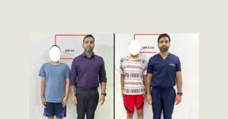 Before-after-banner-1