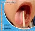 Autism Treatment, Speech Therapy, Hearing Aid Centre for Kids & Children in Ludhiana Punjab https://www.ayushspeechtherapy.com +91-7700007423, 8699877703