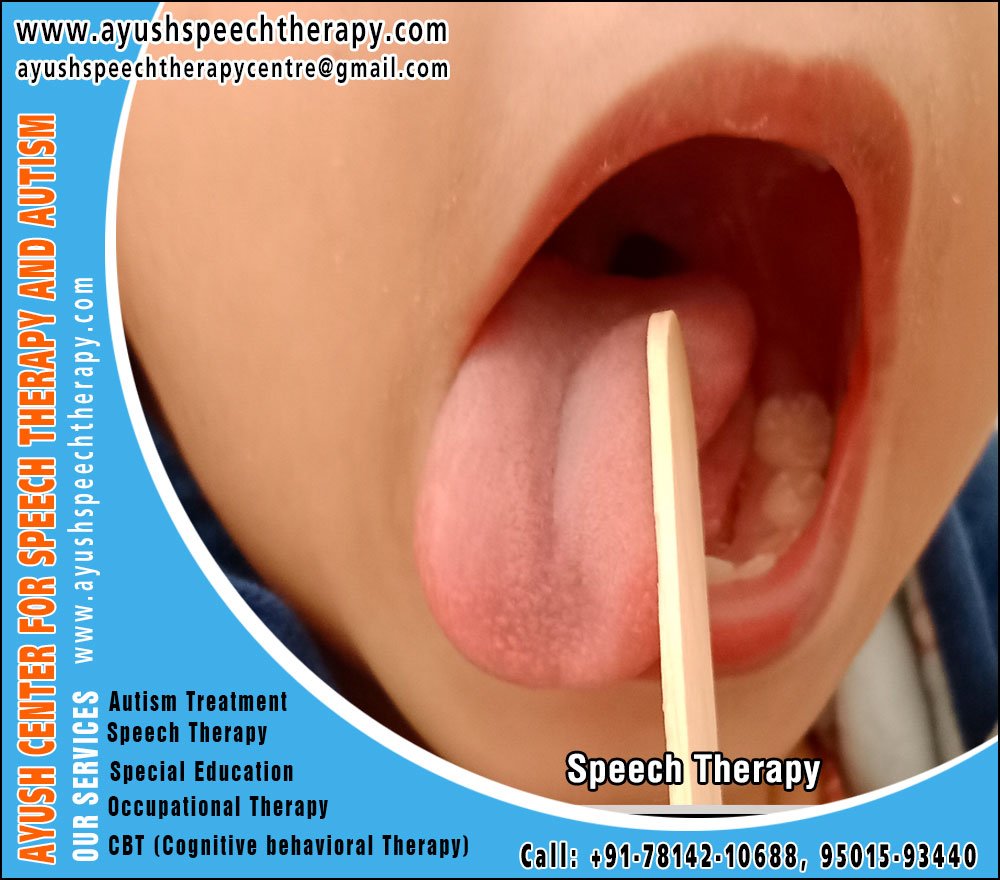 Autism Treatment, Speech Therapy, Hearing Aid Centre for Kids & Children in Ludhiana Punjab https://www.ayushspeechtherapy.com +91-7700007423, 8699877703