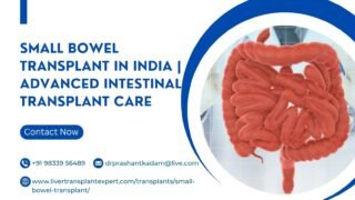 Small-Bowel-Transplant-in-India-Advanced-Intestinal-Transplant-Care-1
